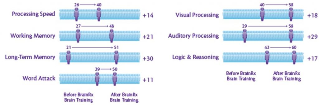 Why Choose Brainrx